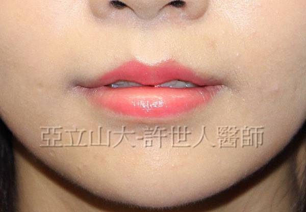 5 微笑嘴唇 2