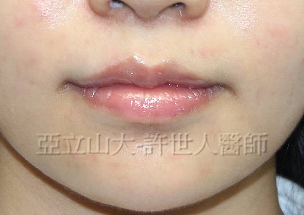 5 微笑嘴唇 7