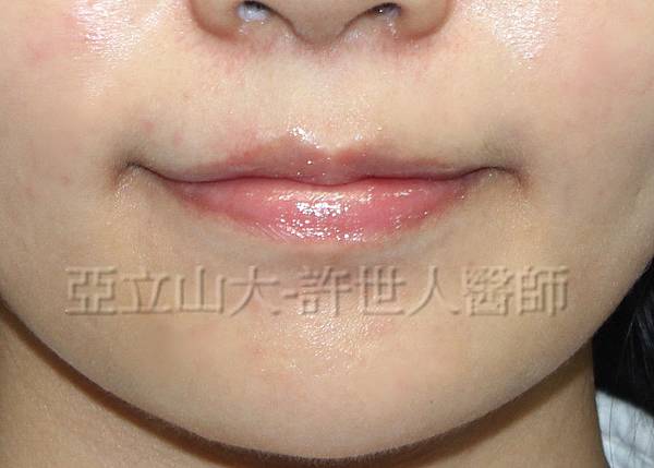 5 微笑嘴唇 8