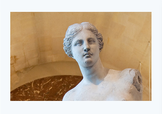 visu liposuction 4 1a