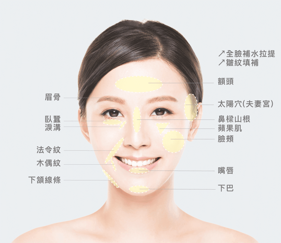 Hyaluronic acid injection 03