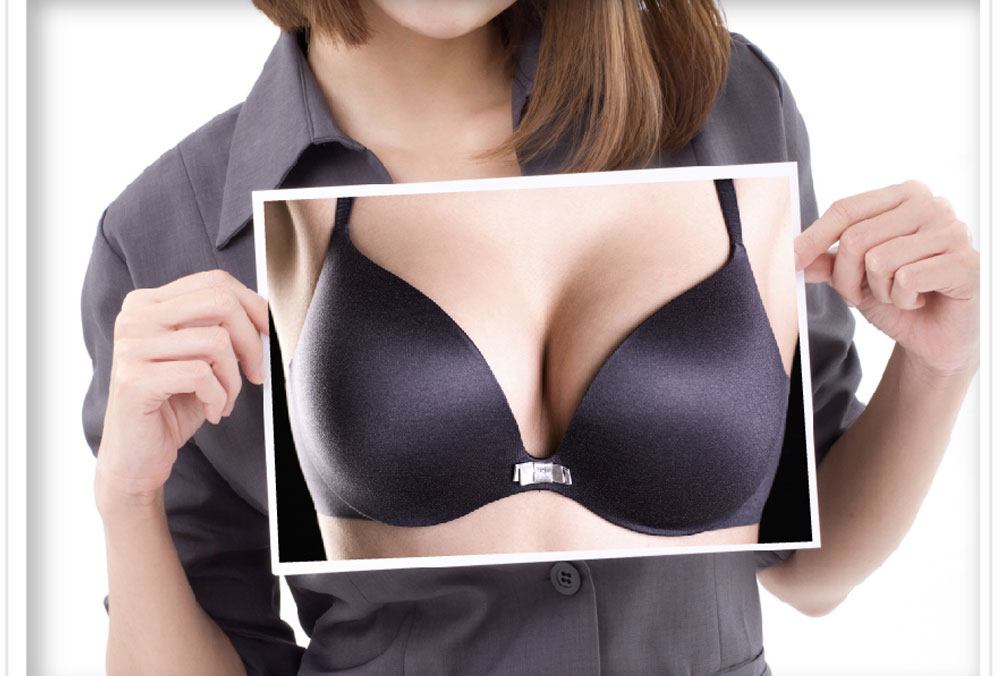 SIEF假體脂肪置換隆乳術 3