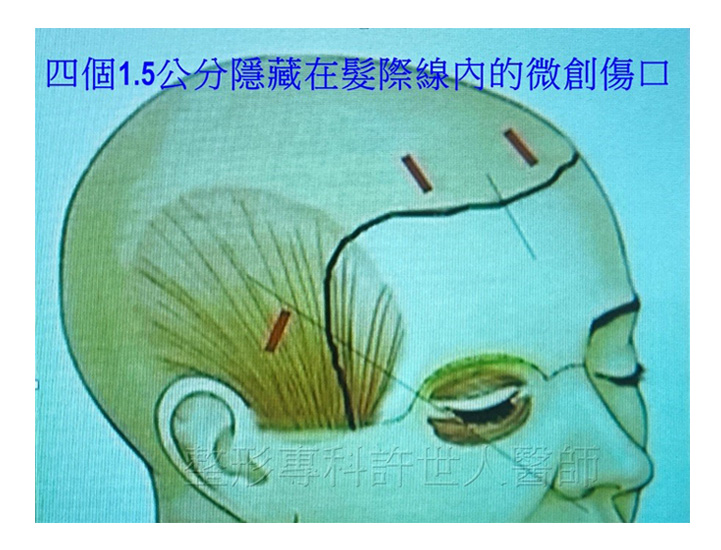 五爪鉤20210530-2 五爪鉤20210530 2