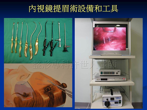 內視鏡提眉術設備和工具-1 內視鏡提眉術設備和工具 1