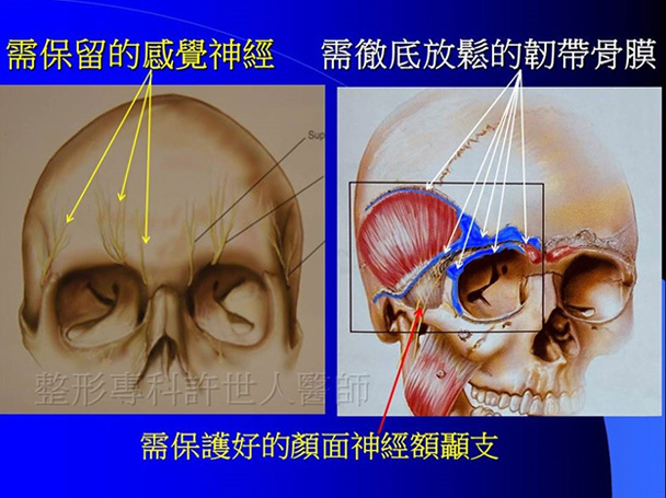 內視鏡提眉術設備和工具-3 內視鏡提眉術設備和工具 3