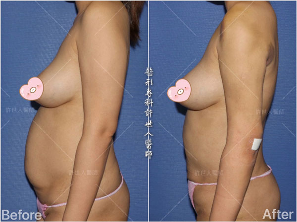 腰腹環抽圖片11-(1) 腰腹環抽圖片11 1