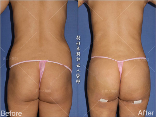 腰腹環抽圖片11-(2) 腰腹環抽圖片