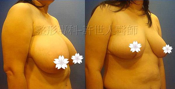 1489513984 2151557336 n